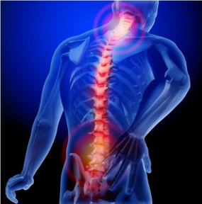 Ankilozan Spondilit Kök Hücre Tedavisi