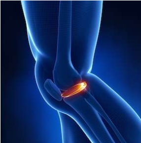 Menisküs Nedir? Menisküs Kök Hücre Tedavisi Nasıl yapılır?