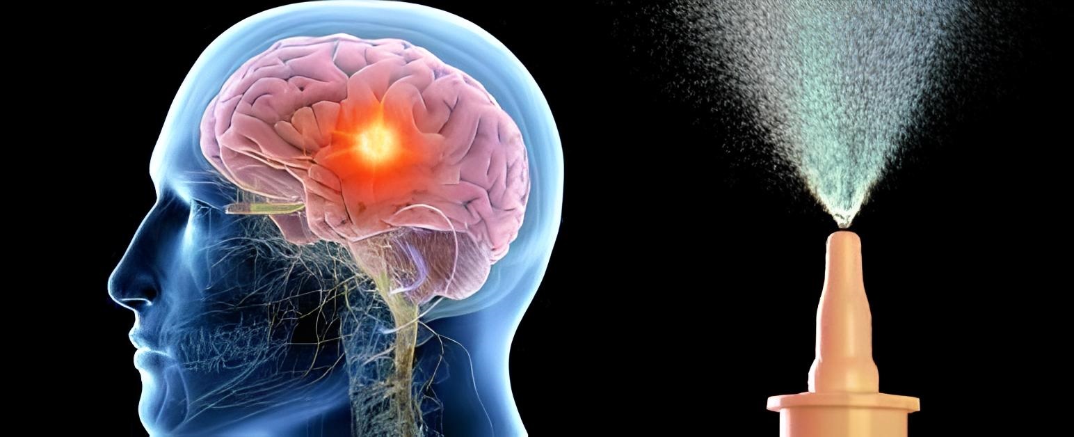 Nörolojik Hastalıklarda Burun Spreyi Eksozom Tedavisi